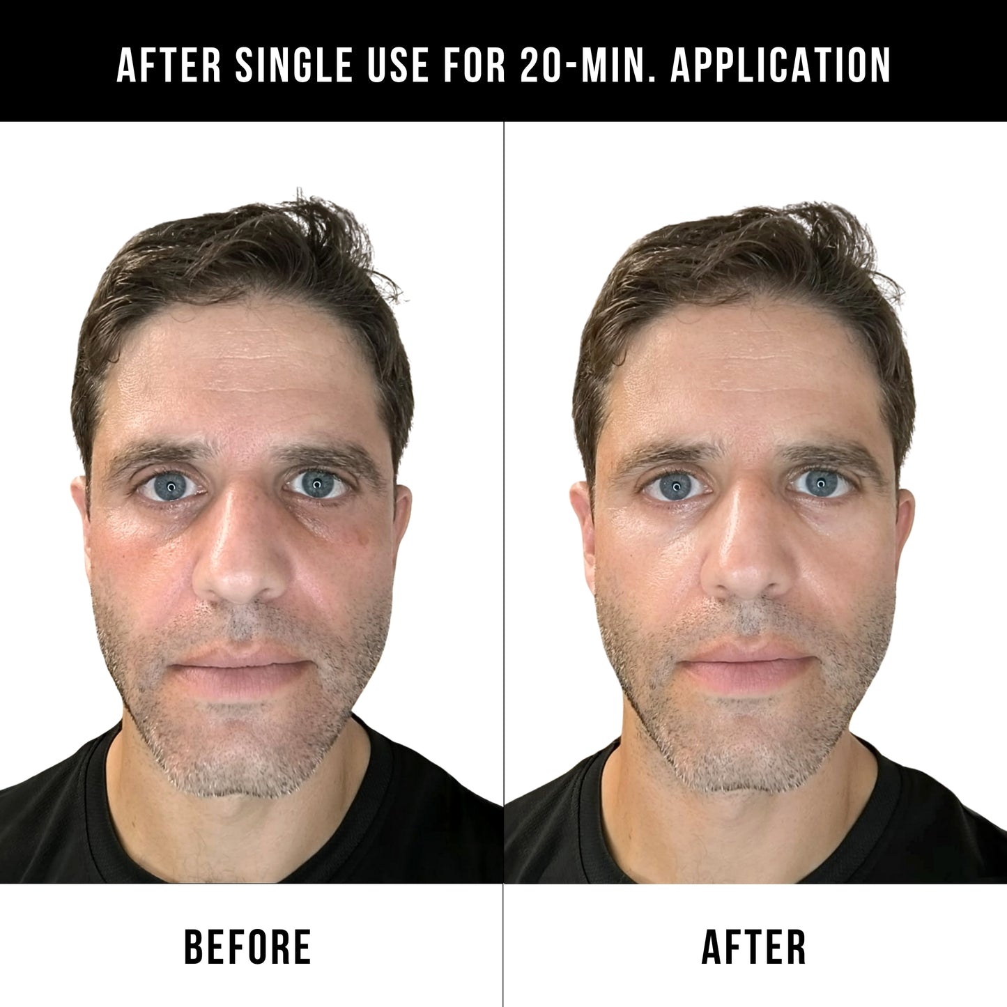 Face Armor Under Eye Battle Strips for Men (Pack of 6)