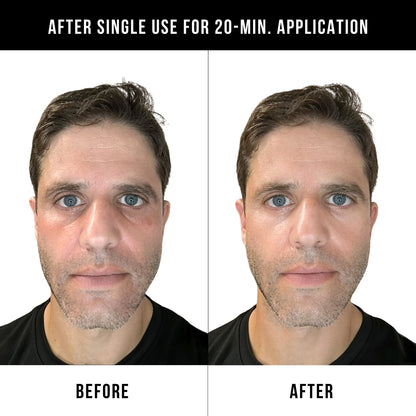 Face Armor Under Eye Battle Strips for Men (Pack of 6)